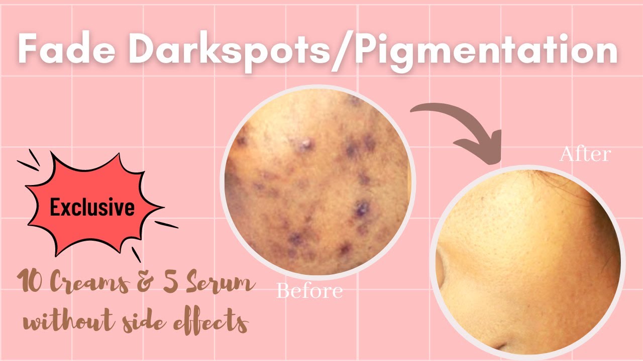 Fade Darkspots/Pigmentation in a safe way|Creams & Serum recommendations in tamil