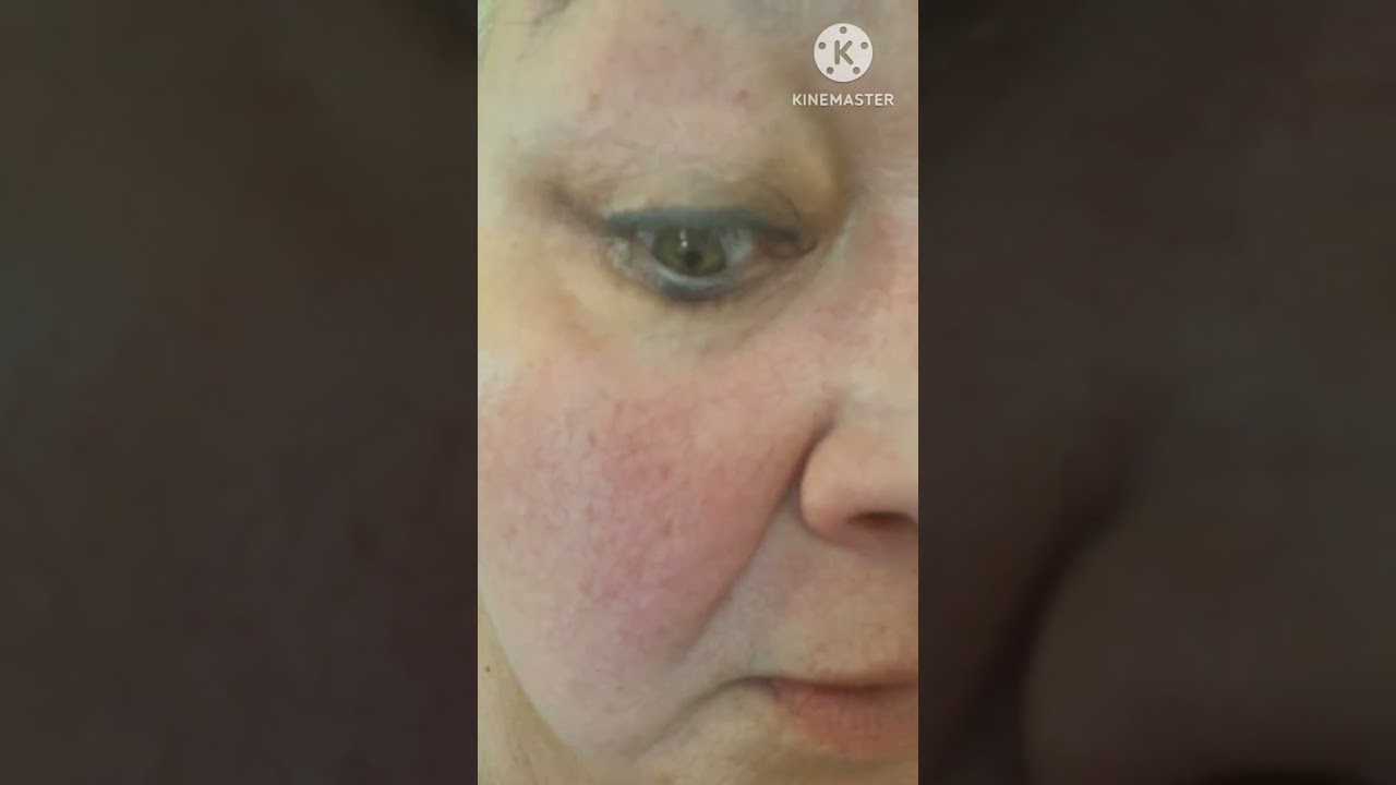 Natural Skin Care With Clinical Pharmaceutical Grade Essential Oils