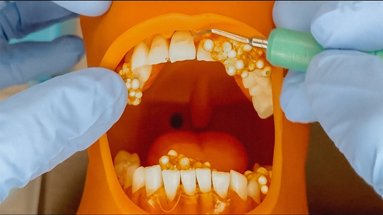 [ASMR] Dentist | Cleans & Whitening Your Teeth 🦷| DEEP RELAX ...