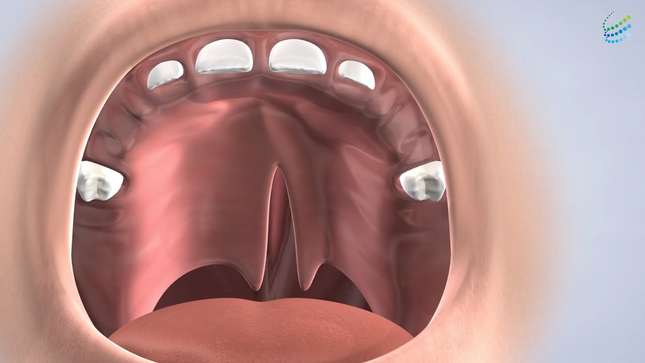 Cleft Lip Palate In Metairie And Gretna La