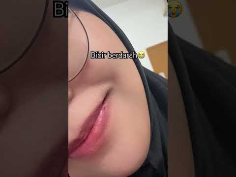 Berdarah😩