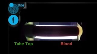 Smartphones ensure accurate medical tests at UVA screenshot 4