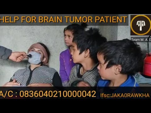 #SOS Brain Tumor Patient Needs Help  | Team MAD. | Share - #SOS Brain Tumor Patient Needs Help  | Team MAD. | Share