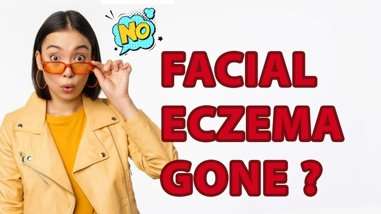 KOREAN BEAUTY TIPS FACIAL ECZEMA HEALING PRODUCT REVIEW HEMOHIM