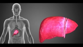 Živeti Zdravo Ciroza Jetre