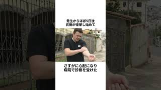 頭に弾丸あるのに4日間パーティーしてた男の末路 #雑学 #一分でわかる