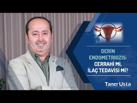 Derin Endometriozis: Cerrahi mi, İlaç Tedavisi mi?