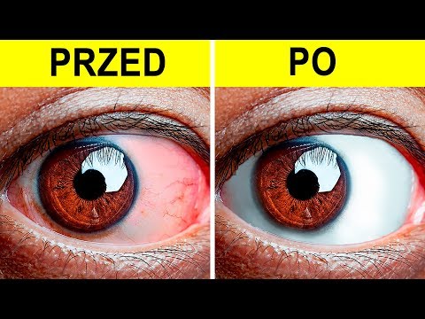 Wideo: Jak Pozbyć Się Czerwonych Oczu