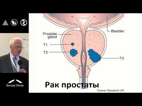 Гормон-ассоциированное предупреждение рака молочной и предстательной железы