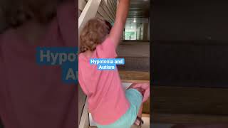 Look at then vs now with Hypotonia #shorts #toddlers #cute #specialneeds #thenandnow