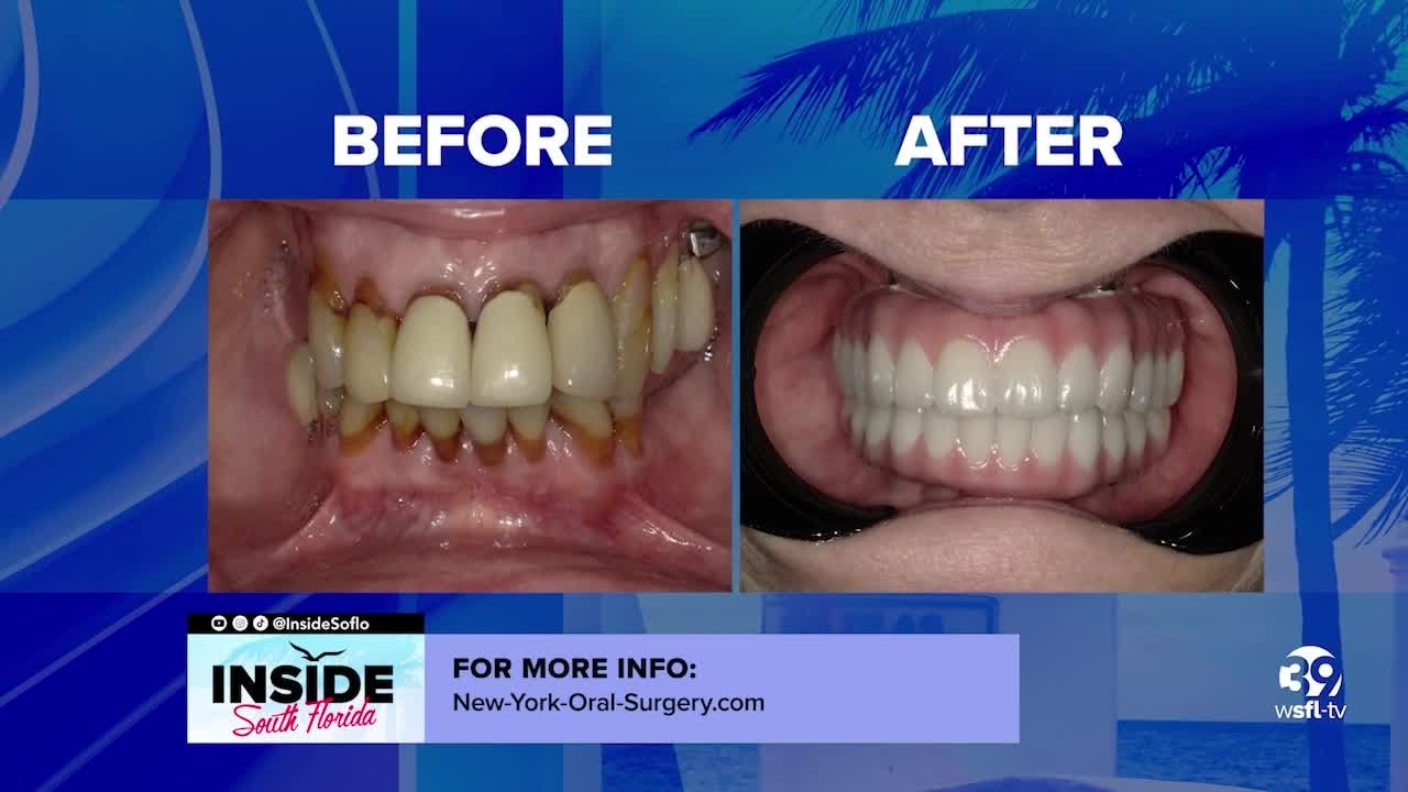 Dental advancements improving smiles in less time