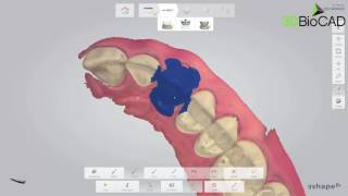 3D BioCAD - TRIOS 3 How to utilize Preprepration Copy Function Net Worth