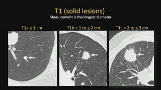 Celebrity ARRS Radiology Subspecialty Case Review 2024 - RT01  Radiology Review Track - Chest Imaging Wealth