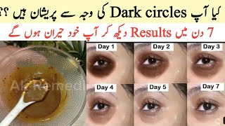 How to Reduce Dark Circles Naturally | Easy Home Remedy | Dark Circles Removal Remedy at Home