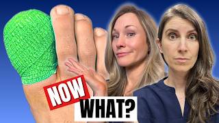 Had an Ingrown Toenail Removed? Here's What To Do Next (Podiatrist Guide)