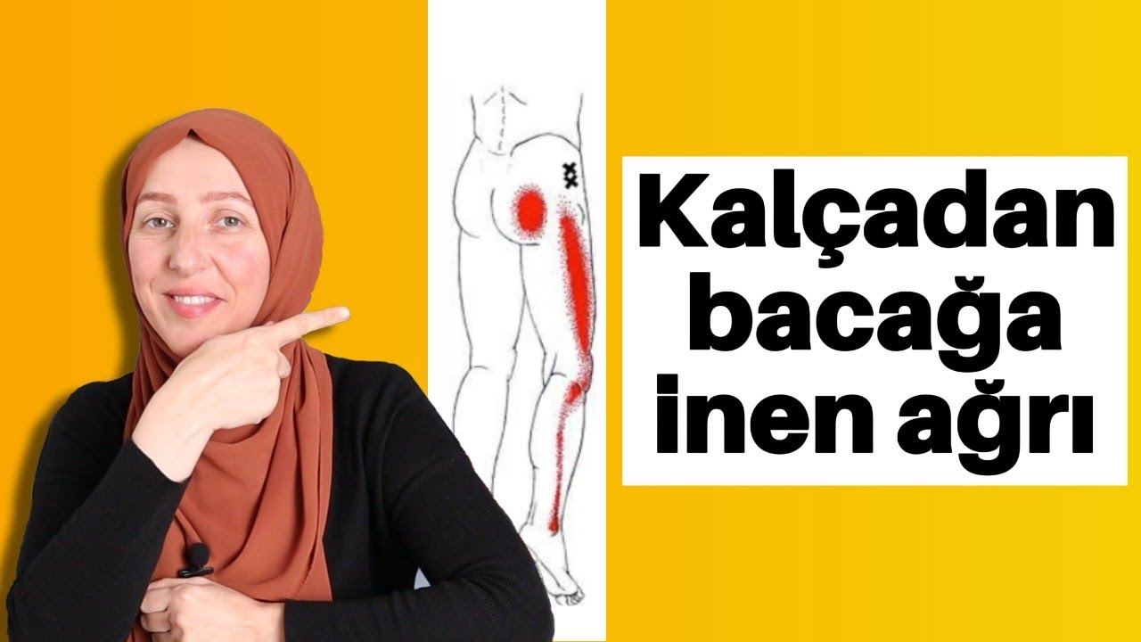 Priformis Sendromu: Kalça Ağrısının Gizli Sebebi