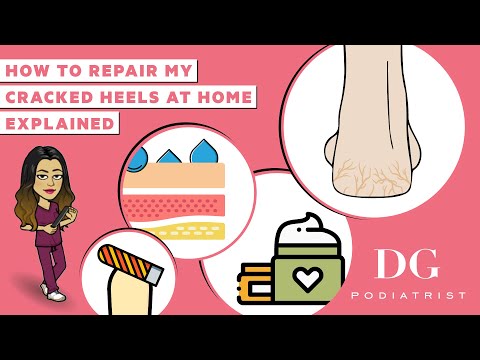 How to repair cracked heels at home| Cracked heels series | The Foot Scraper: DG Podiatrist