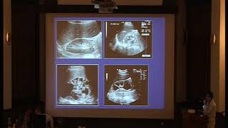Radiological aspects of Renal failure and hemodialysis part 1 prof   Mohammed Abu Ghar