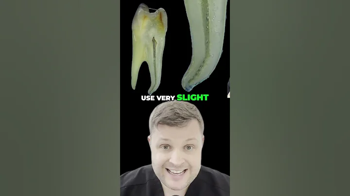 How to Smooth Off a Ledge with Hand File  Expert Techniques Revealed