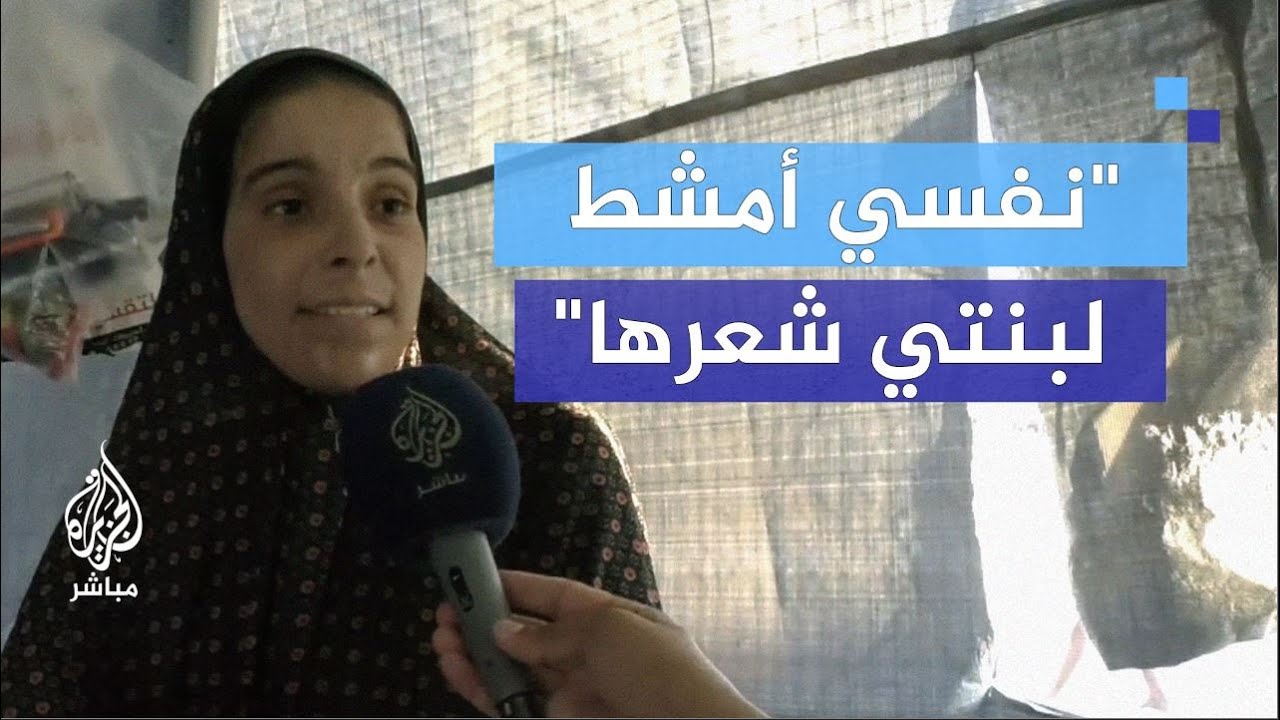 زوجة شهـ.ــيد مصابة: نصف حياتي واقف بسبب إيدي اليمين