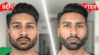 I Spent $100K in Plastic Surgery to Become Attractive | LooksMaxxing screenshot 3