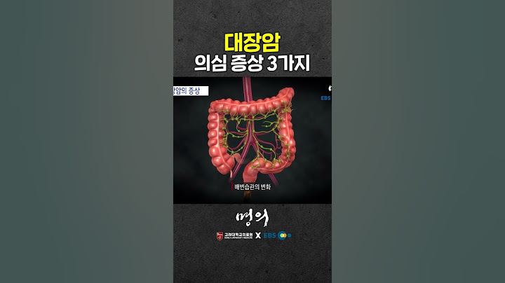 3 suspected symptoms of colon cancer