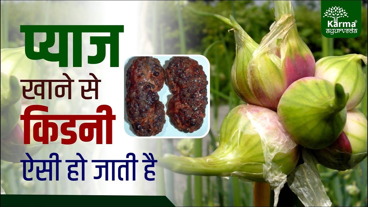प्याज खाने से किडनी ऐसी हो जाती है Onion for Kidney Patients Kidney