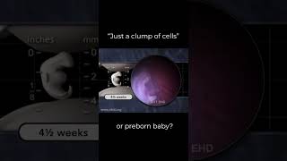 Is This Really "Just a Clump of Cells"? 🤔
