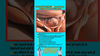 उल्टा बच्चा कैसे पैदा होता है?😱  Breech Delivery की पूरी सच्चाई  Normal या C-Section? pregnancy tips