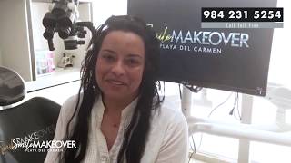 Smile Makeover Review Excellent Service Prices in Playa del Carmen Mexico