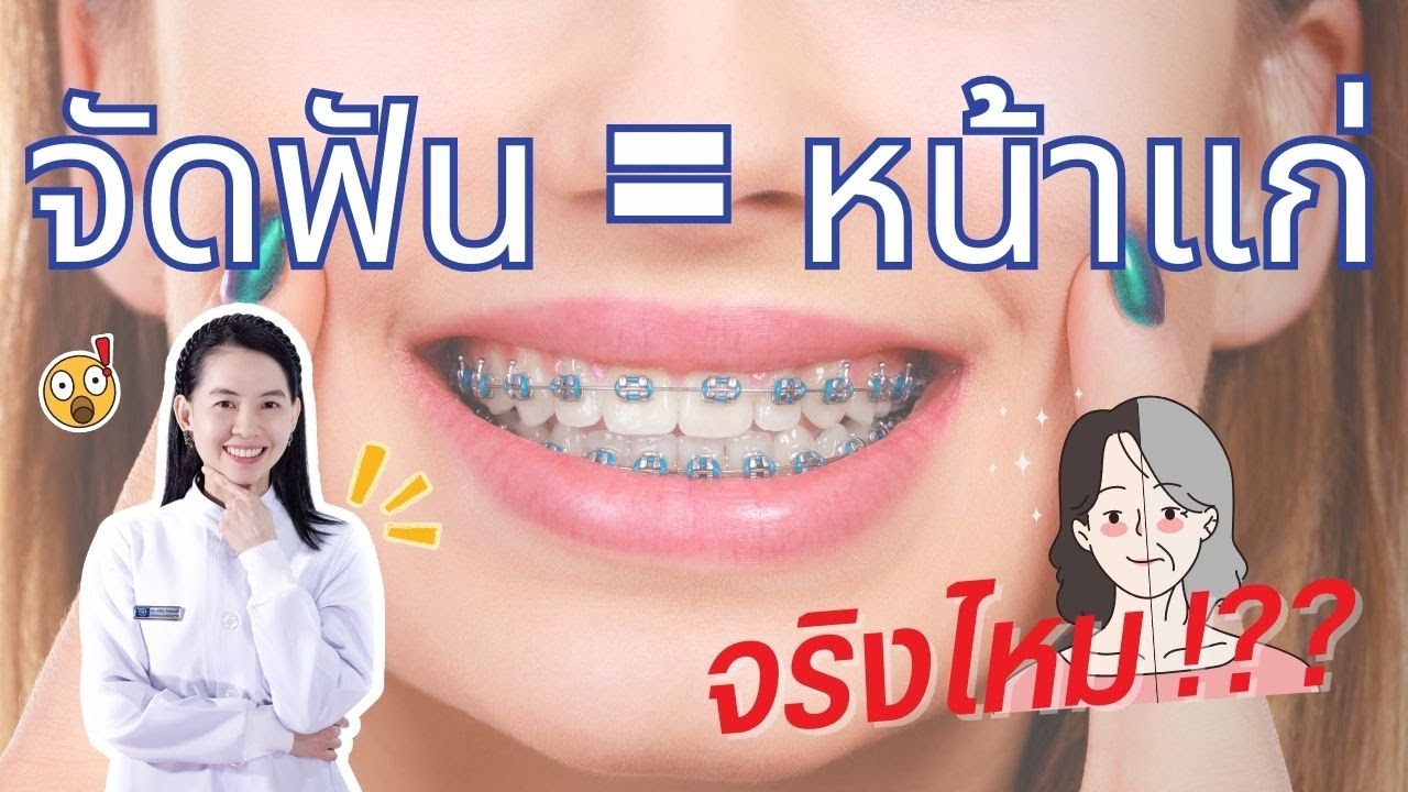 จัดฟันทำให้หน้าแก่ขึ้นจริงไหม !?!