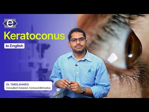 Keratoconus | Causes, Symptoms, Treatment | Keratoconus Treatment | The Eye Foundation #keratoconus