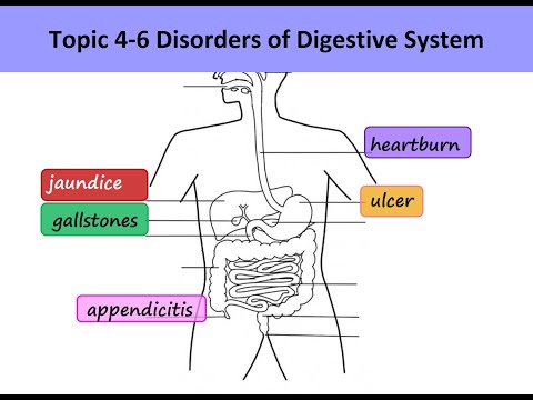 Digestion 7  Disorders