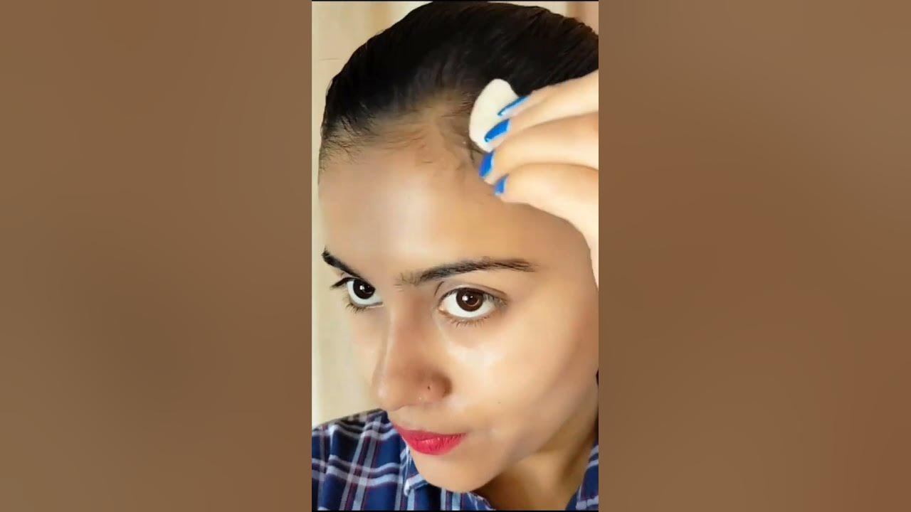  New baby hair regrowth only 2-3 weeks 🔥😍 #shorts #youtubeshorts # ...