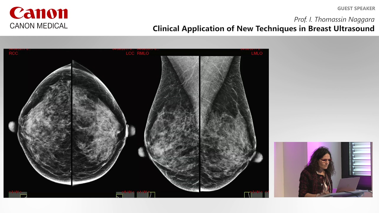 ECR 2019 Symposium Clinical Value of Ultra High Frequency in Breast