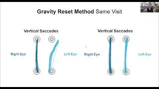Calibrate the brain's compass with the Gravity Reset Method