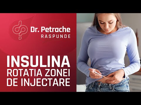 Video: Locuri primare de injectare a insulinei