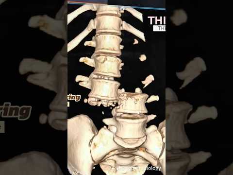 🚨RADIOGRAFÍAS más RARAS y TRÁGICAS HISTORIAS #Shorts