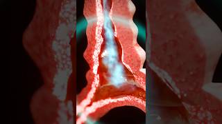 What Causes Asthma? 🤔 #shorts