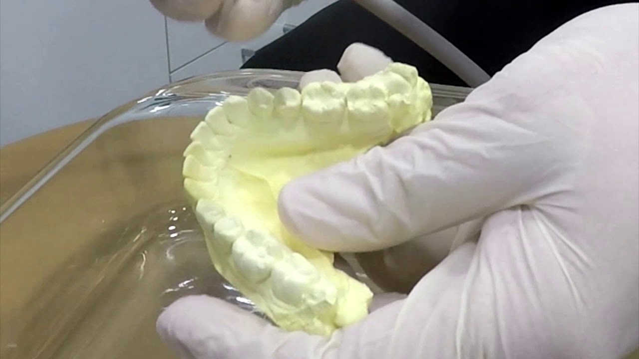 Dental Members Dentist DM Aligner IPR training. YouTube