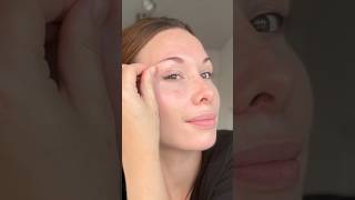 Crows Feet Wrinkles Puffy Eyes Mage