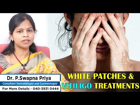 Advanced Treatments for Vitiligo | #Leucoderma | White Spots and Patches on Skin