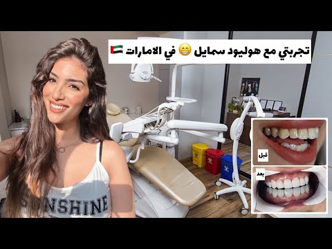 تجربتي مع الهوليود سمايل😁 في الإمارات 🇦🇪بدونبرد أسنان 🦷واش نصحكم بيها أو لا❓مشاكل وسلبيات وإيجابياته