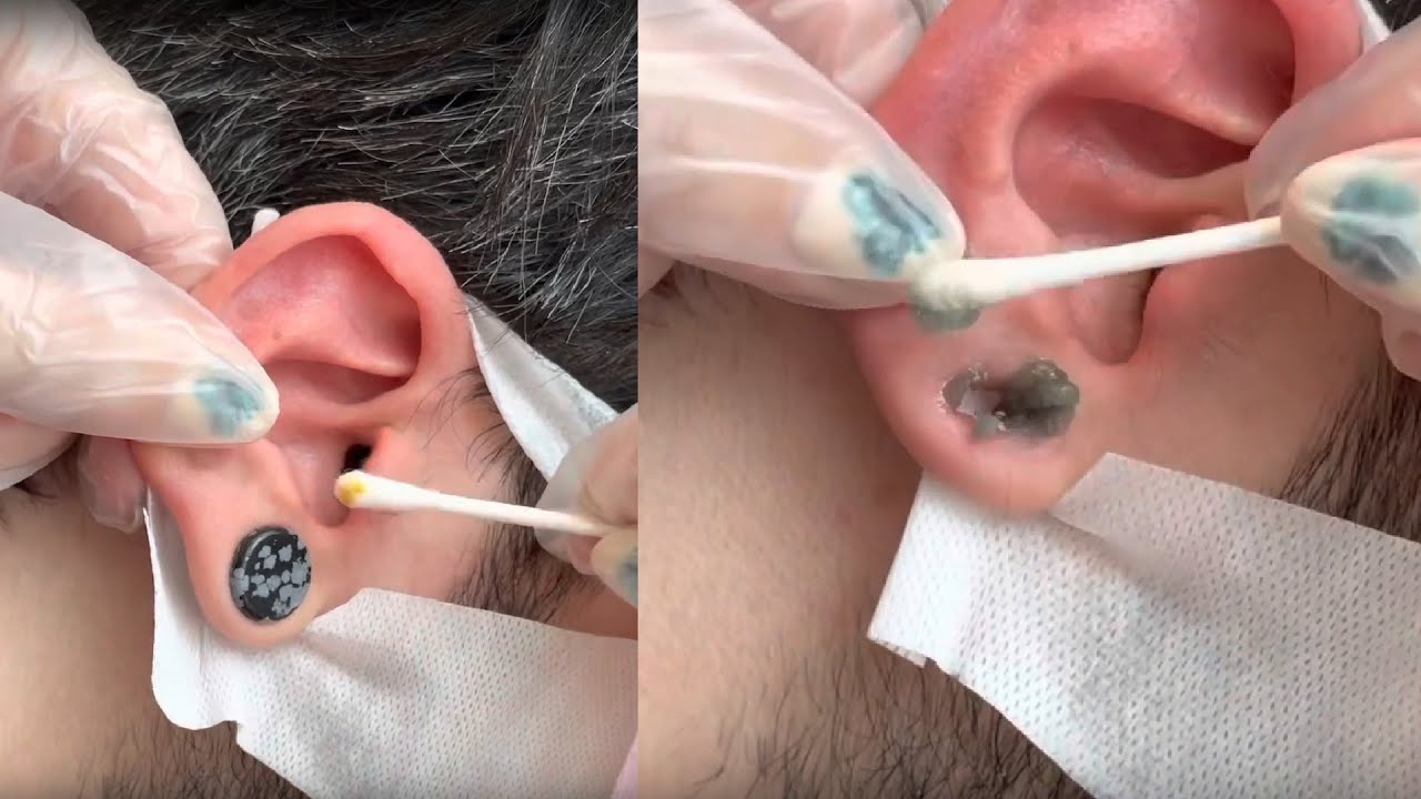 EAR CLEANING ASMR - wax removal and massage