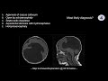 Neuroradiology Board Review - Pediatric Case 4