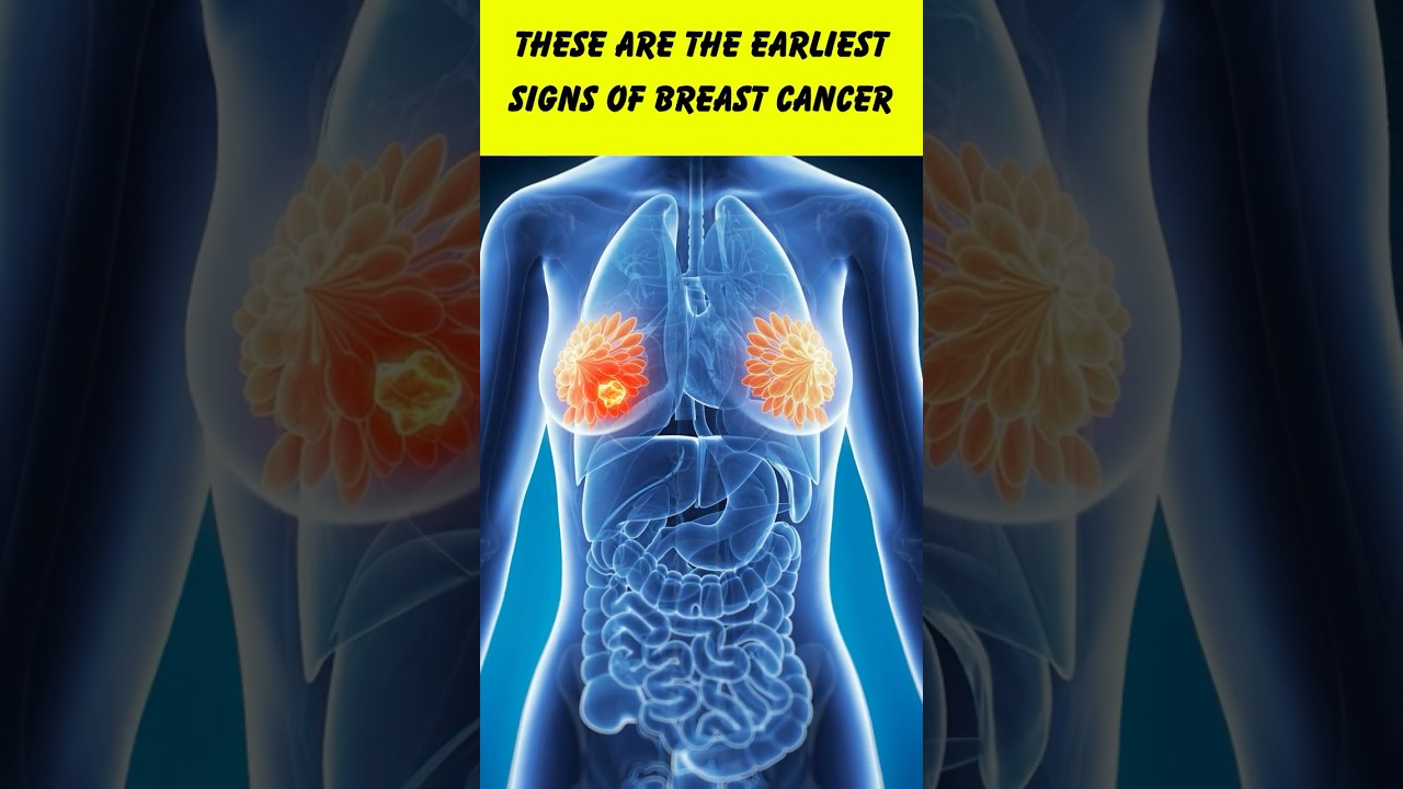 5 Early Signs of Breast Cancer You Should Never Ignore