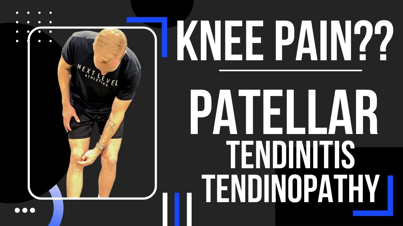 Fix Athlete Knee Pain Patellar Tendinopathy/Tendonitis YouTube