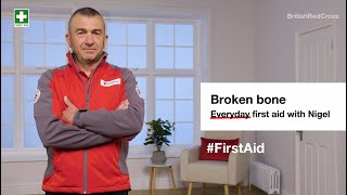 Broken Bone First Aid Steps And Key Action