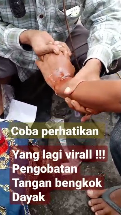 Pengobatan Tulang Bengkok virral ‼️pengobatan  tulang Bengkok Dayak