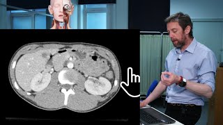 Abdomen transverse CT imaging anatomy